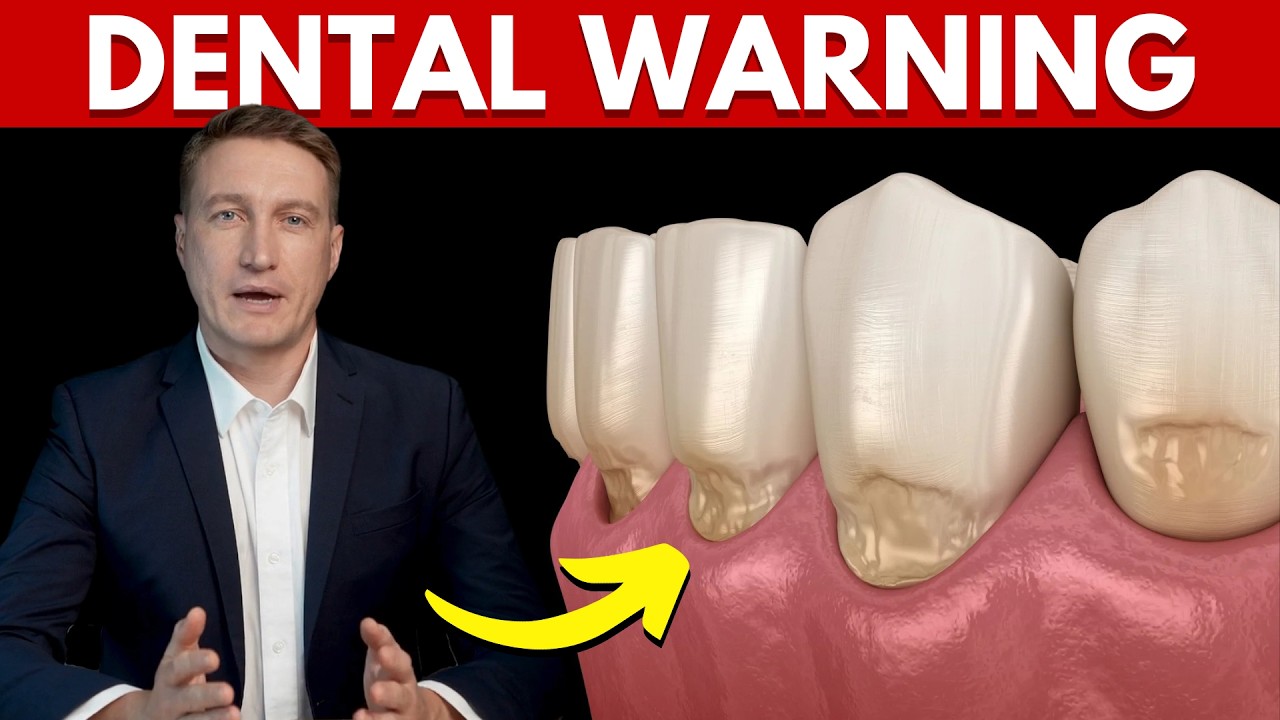 What Happens If You Ignore Notches in Your Teeth – Dr. Lowe On Dental Abfraction