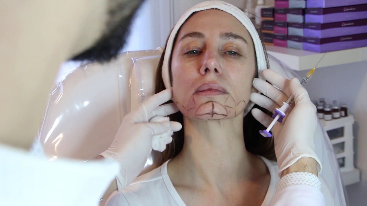 Relleno Facial Tercio Inferior - La Silueta