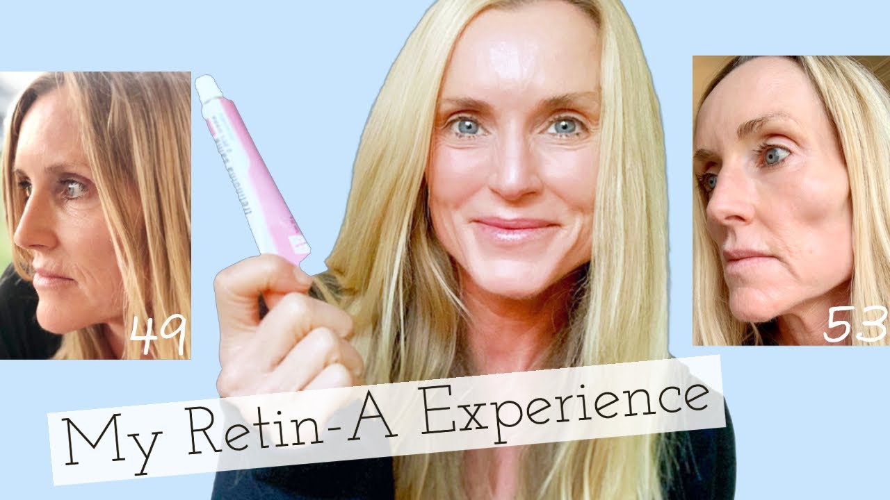 My 3 year Experience with Retin-A | Before & Afters + Tips on how to use Tretinoin w/o Irritation