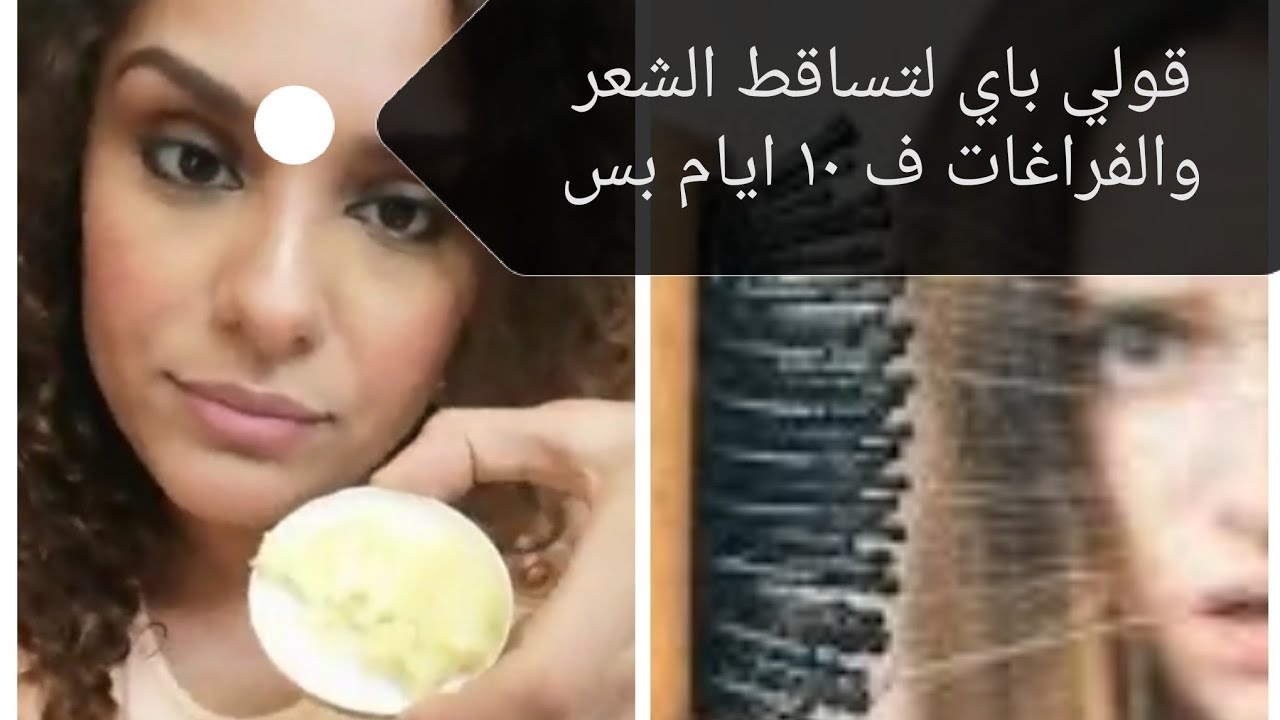 شعري بيتساقط كثير، تعالوا أعرفكم على الحل لتساقط الشعر مع ماسك الثوم السحري