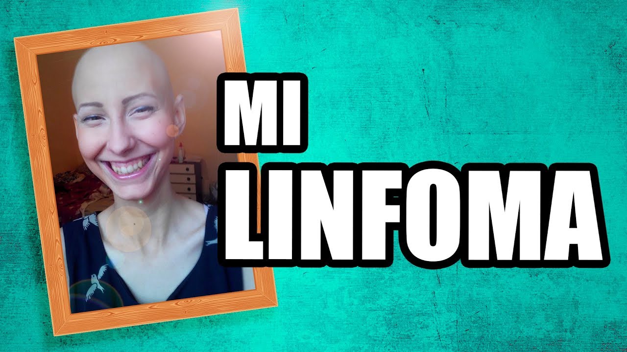 MI LINFOMA