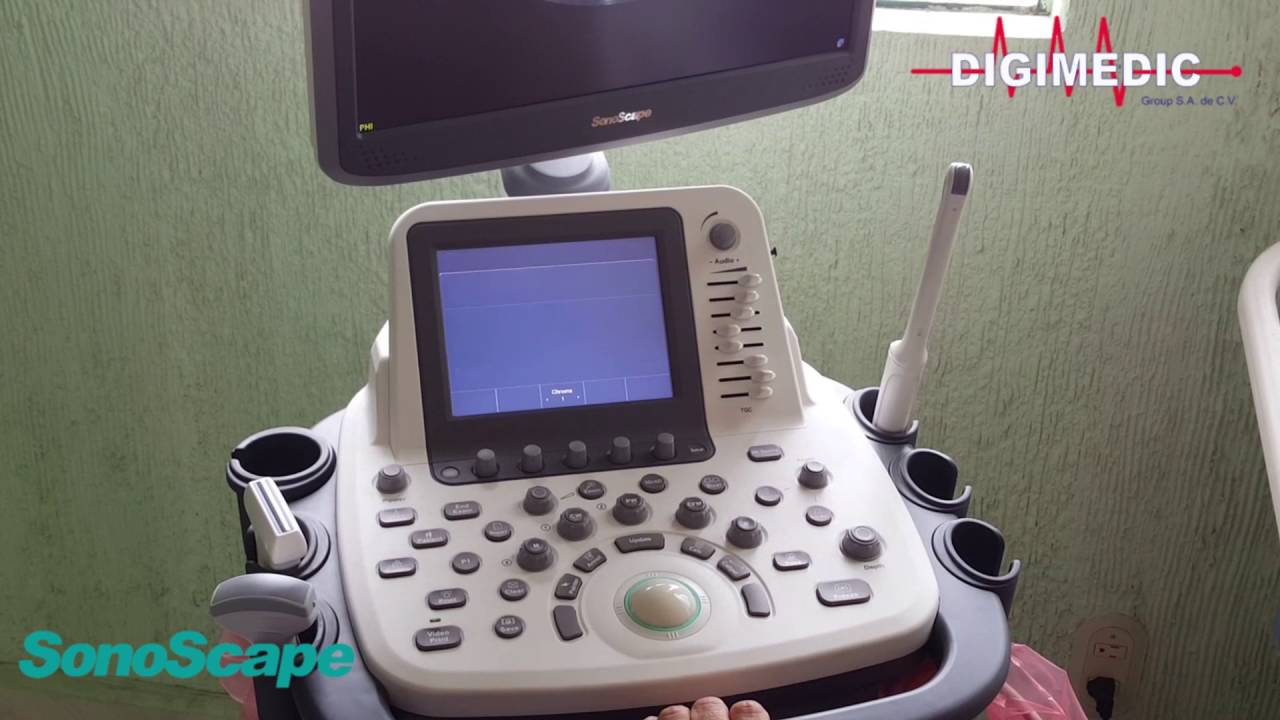 SonoScape S22 PROBANDO CALIDAD DE IMAGENES
