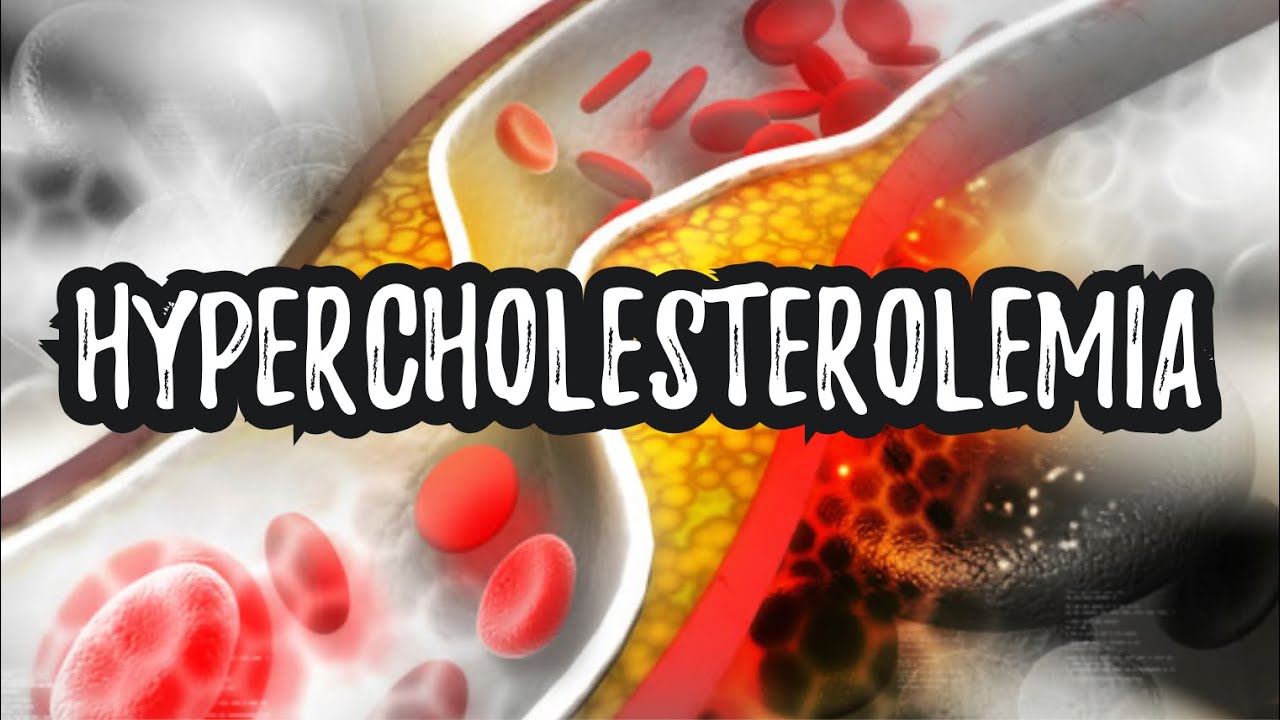 Hypercholesterolemia (High Cholesterol) - CRASH! Medical Review Series