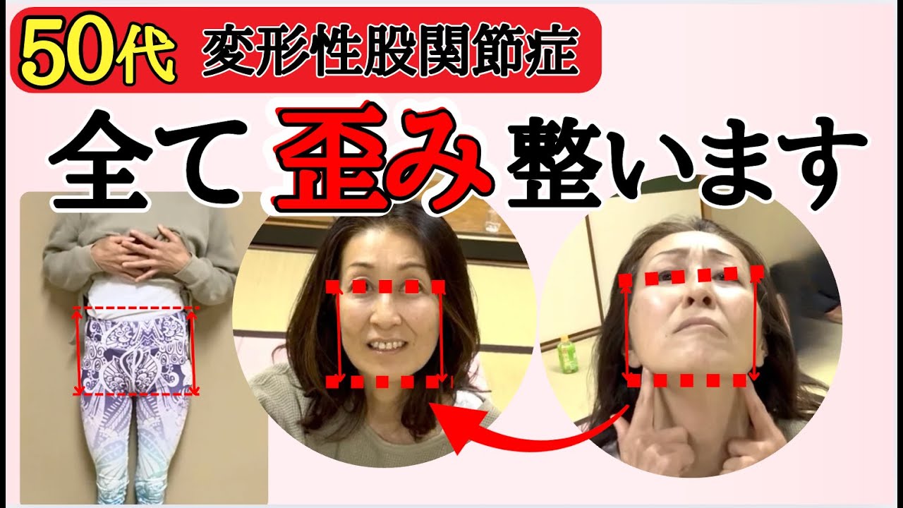 【股関節痛と顎の関係性】顎は骨格を整える際に最も重要視するべきところ！顎のずれは骨格のズレとなるため早急に整える必要がある！