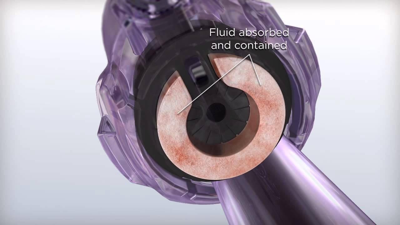 5mm Trocar Usage HD