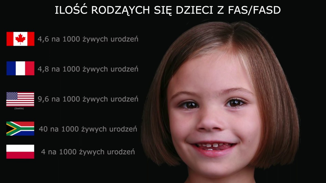 FAS/FASD film edukacyjny - Marcin Miller