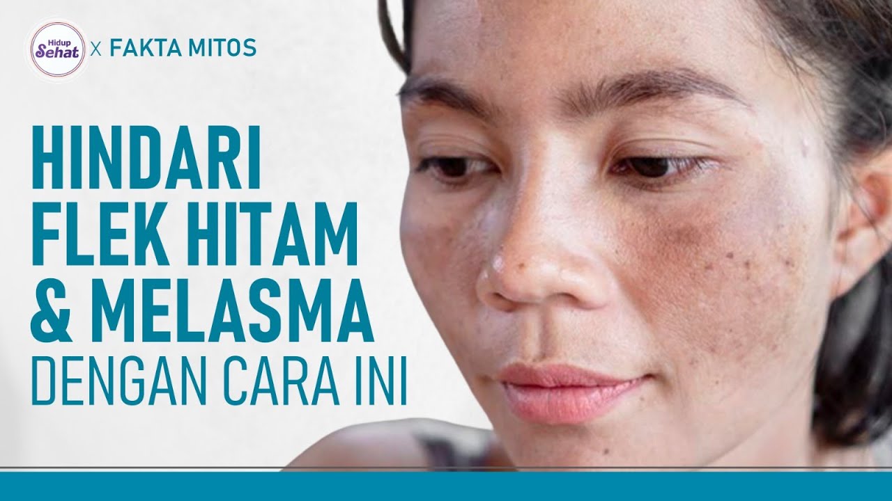 Cegah Flek Hitam dan Melasma, Lakukan Kebiasaan Ini Mulai Sekarang | Hidup Sehat tvOne