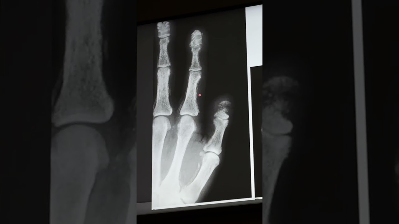 Radiology bone session 6  part 1