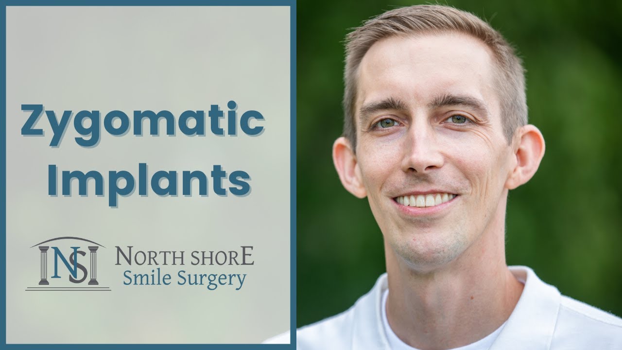 Ryan's Lifestyle Improvement with Full Arch Zygomatic Implants!