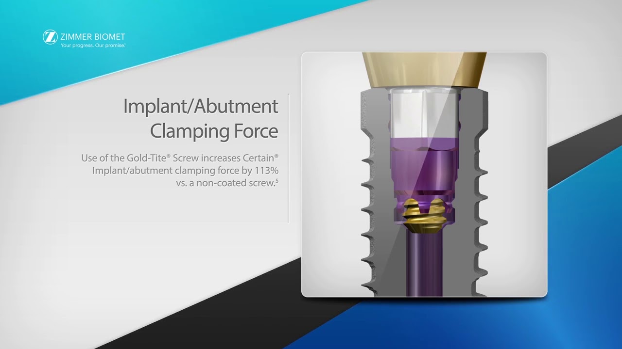 Biomet 3i T3&reg; Implants