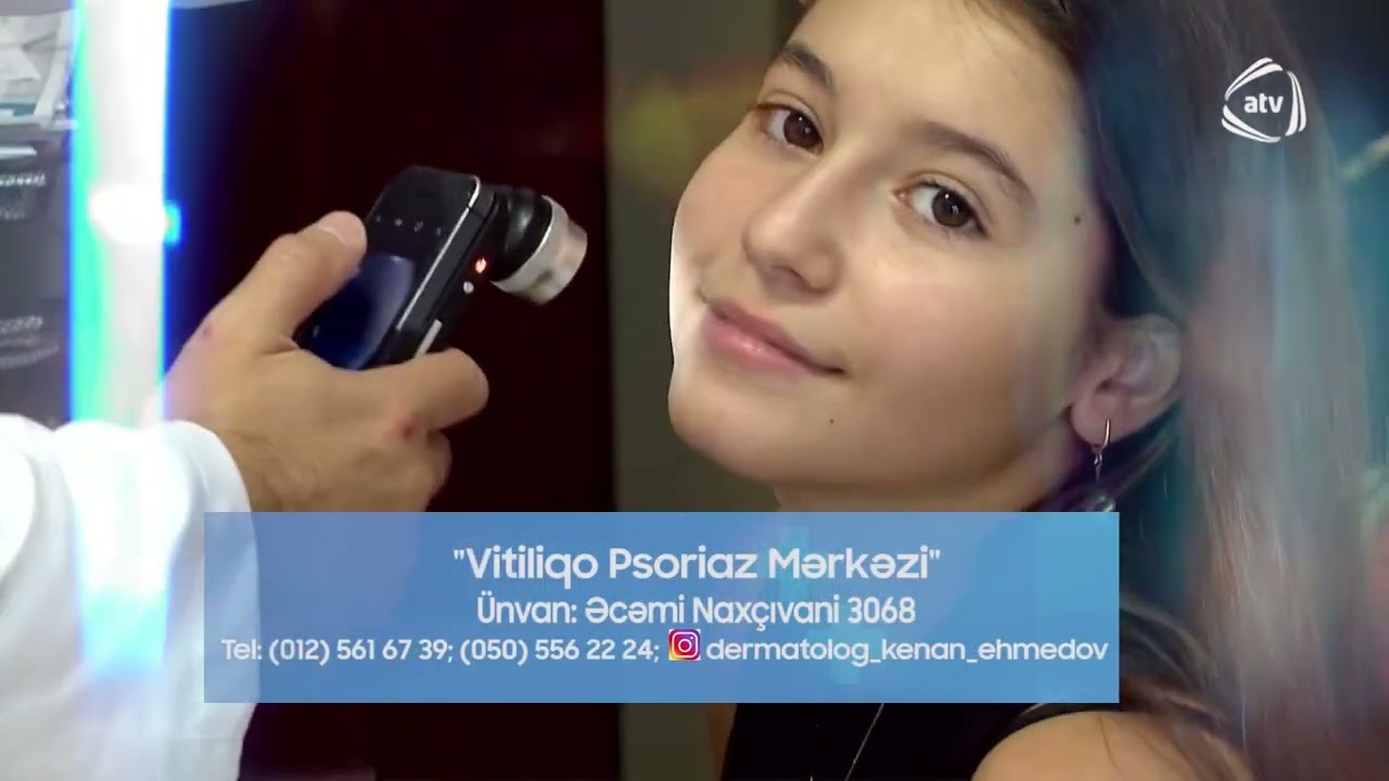 Vitiliqo ve Psoriaz mualicesi Fototerapiya usulu