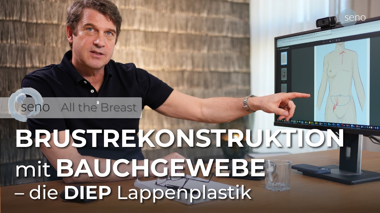 Nach Brustkrebs: Rekonstruktion der Brust mit Bauchgewebe I seno – All the Breast
