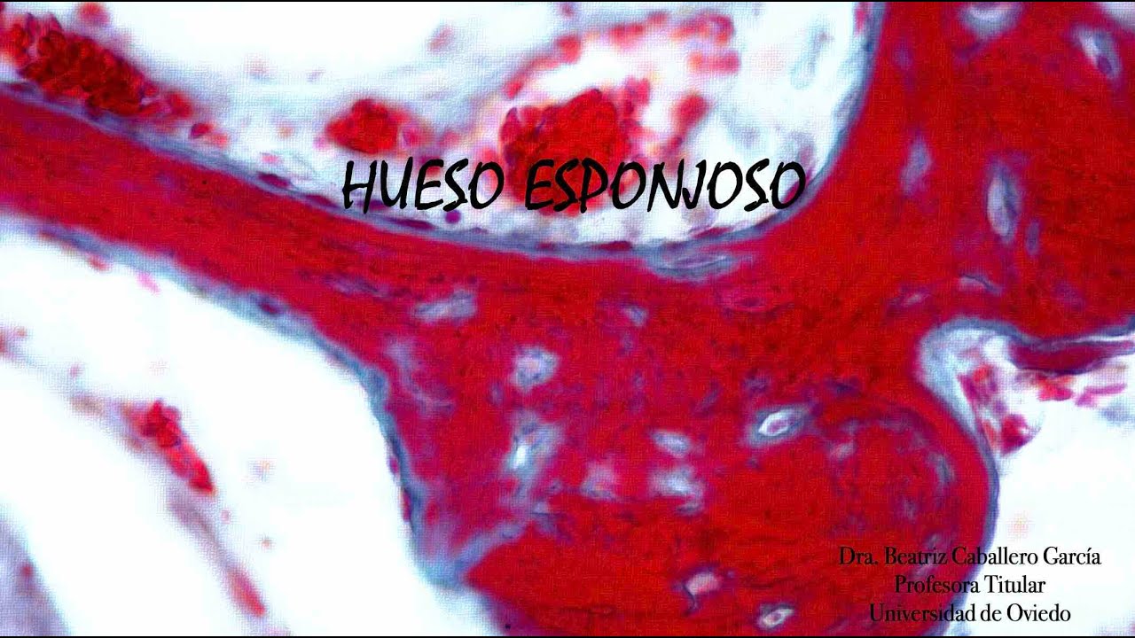 Hueso esponjoso (tricrómico)