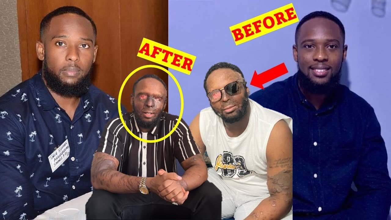 💔YATWIKISHIJWE ACID N'INSHUTI ZE KUBERA ISHYARI NGO ARI KUBAKIRANA BO BARI MU NDAYA AMASO BAYAKURAMO