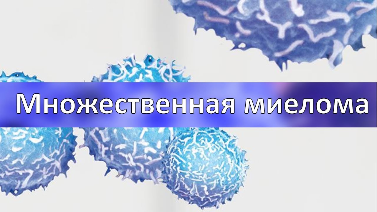 Множественная миелома