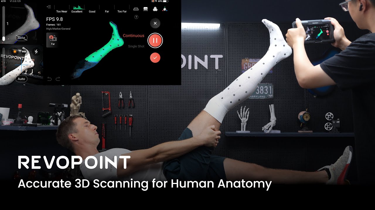 3D-сканеры Revopoint: точное 3D-сканирование анатомии человека