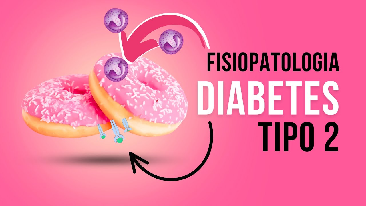 FISIOPATOLOGIA de la Diabetes Tipo 2 | RESUMEN | Explicación fácil