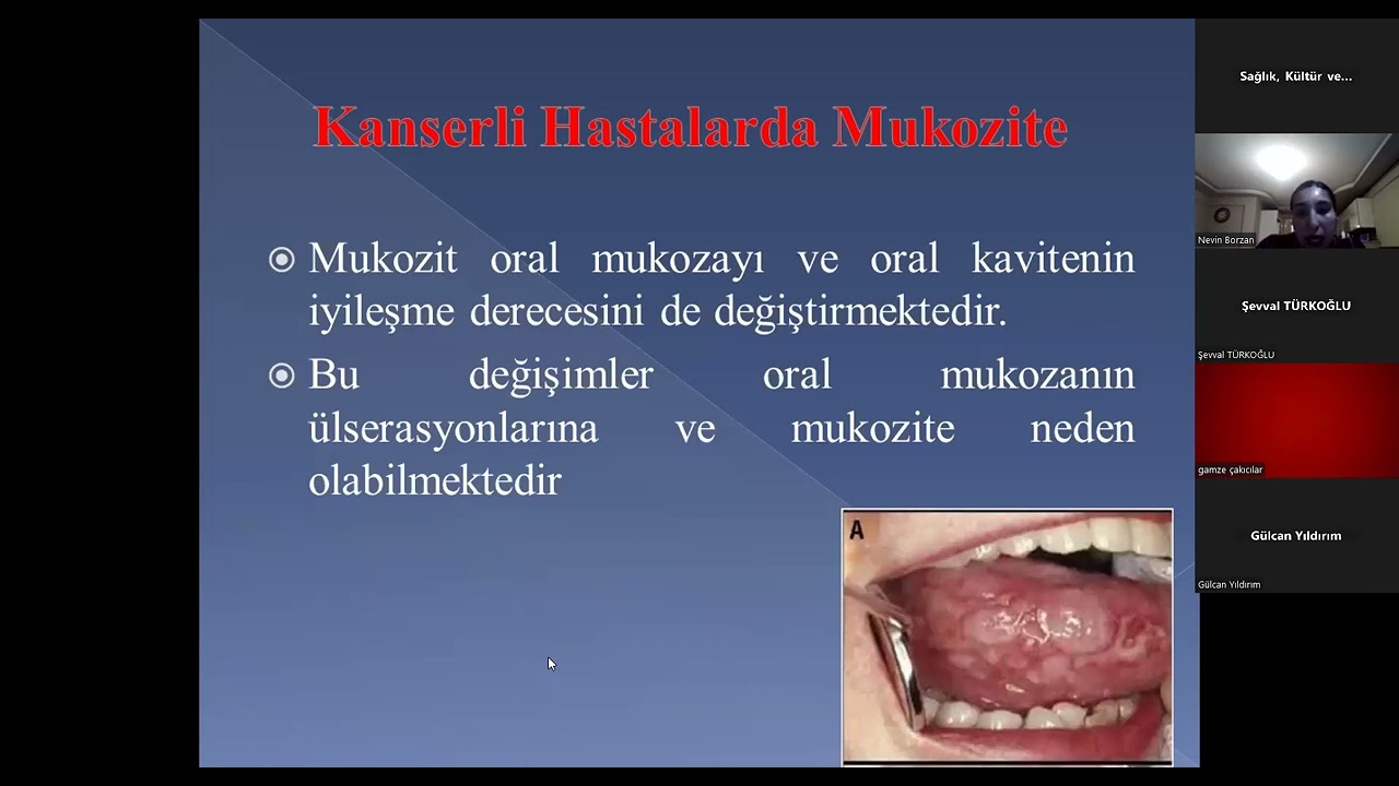 Kanser Haftası Zoom Yayını/ Uzman Diyetisyen Mevin Borzan Onkolojide Beslenme Anlatıyor