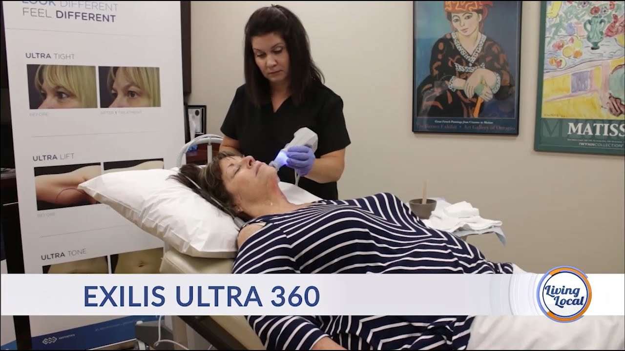 Dermatology and Laser Center of Charleston: Exilis Ultra 360