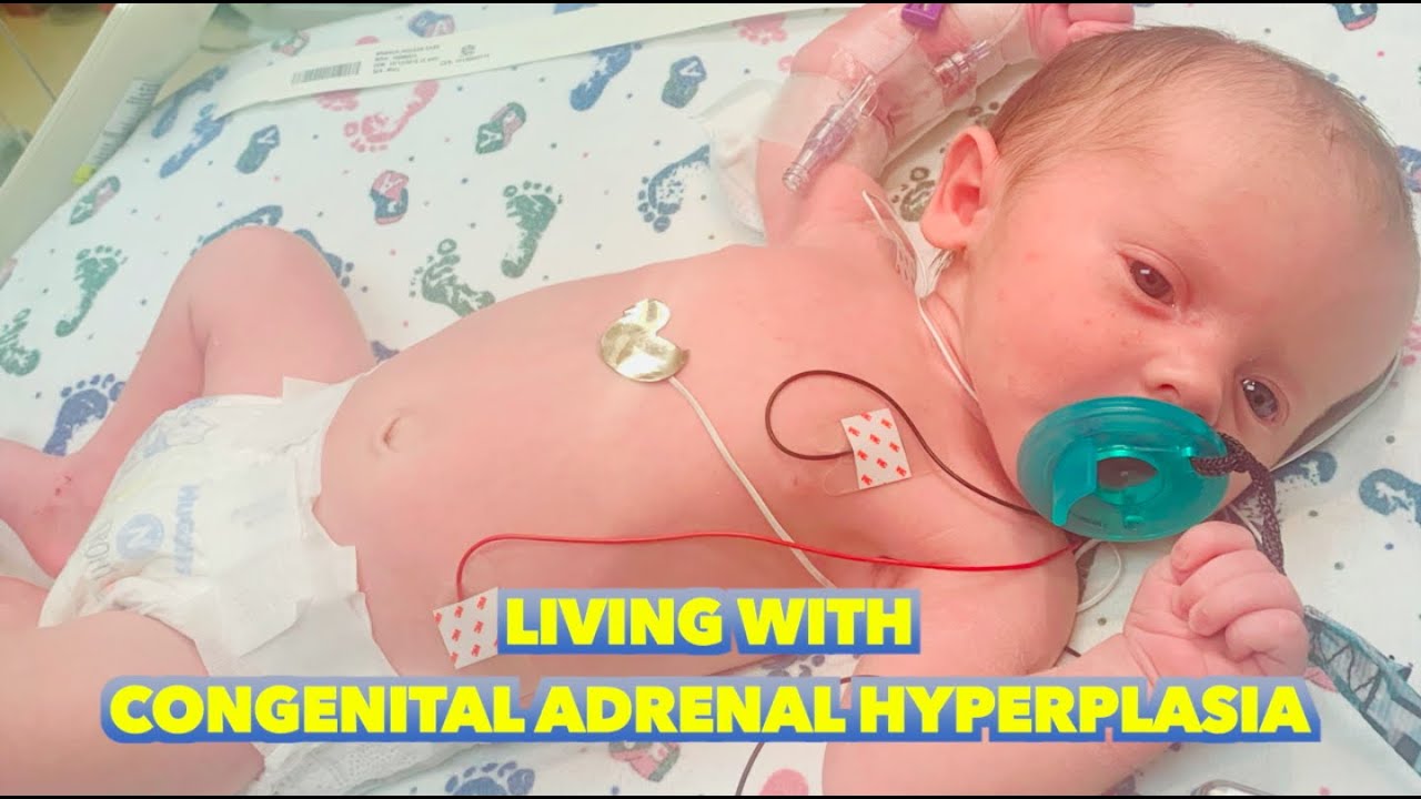 Living with Congenital Adrenal Hyperplasia (1 in Every 18,000 Diagnosed)