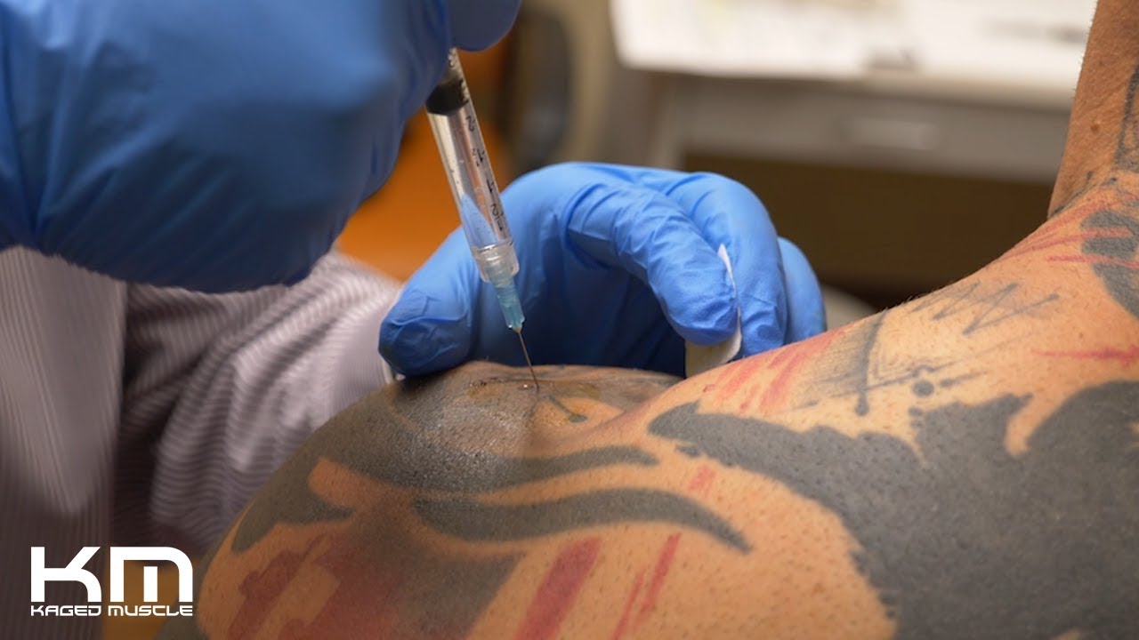 Kris Gethin's Shoulder Surgery Pre-Op Appointment with Idaho Sports Medicine Institute