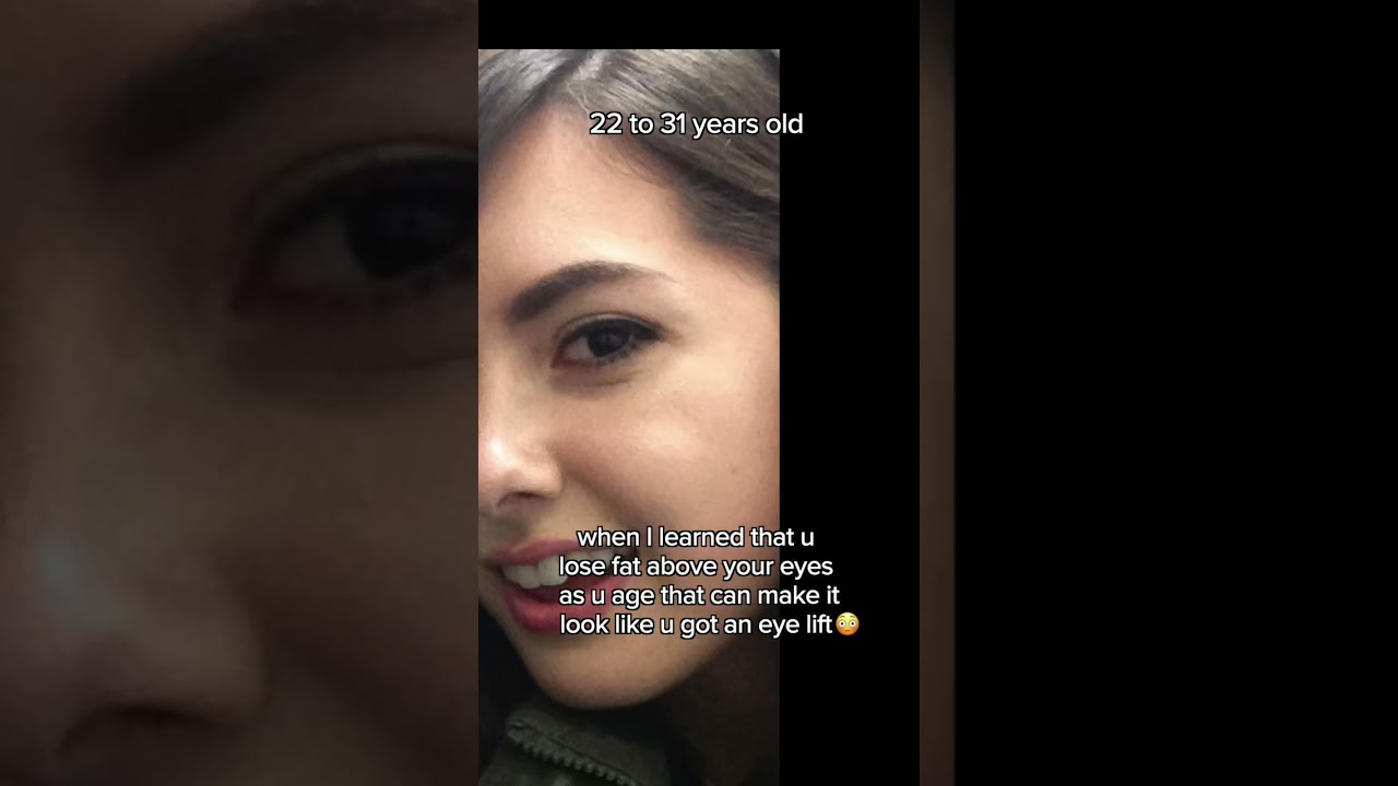 I got an eye lift?👀22 to 31 yrs old🫣