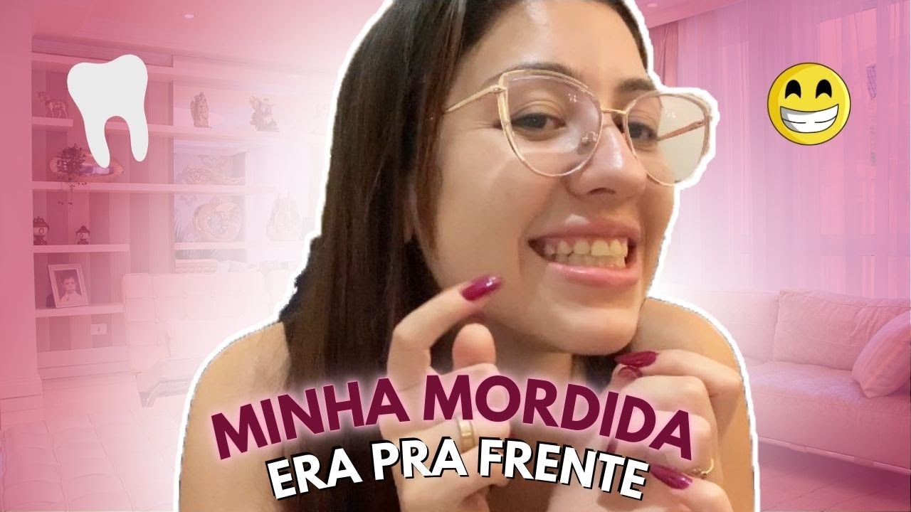 CLASSE 3 EM ORTODONTIA! ANTES E DEPOIS