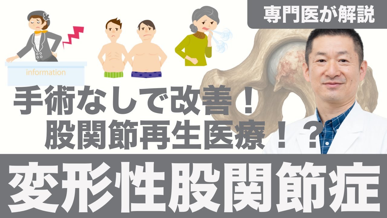 変形性股関節症の手術をしない新しい治療法で歩行が楽になる？股関節の痛みが消える再生医療の驚きの効果。再生医療のPRP療法とは？幹細胞治療、エクソソーム療法との違い