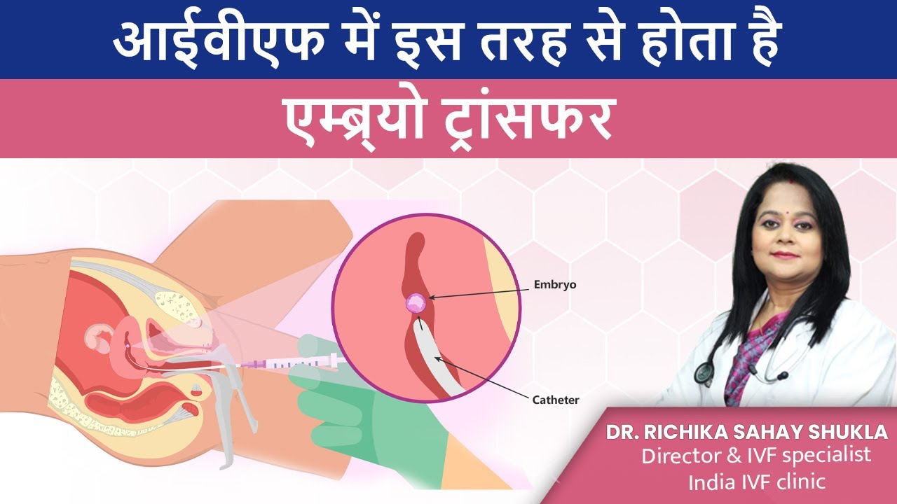 आईवीएफ में इस तरह से होता है एम्ब्र्यो ट्रांसफर  - Embryo Transfer Process | Dr Richika Sahay Shukla