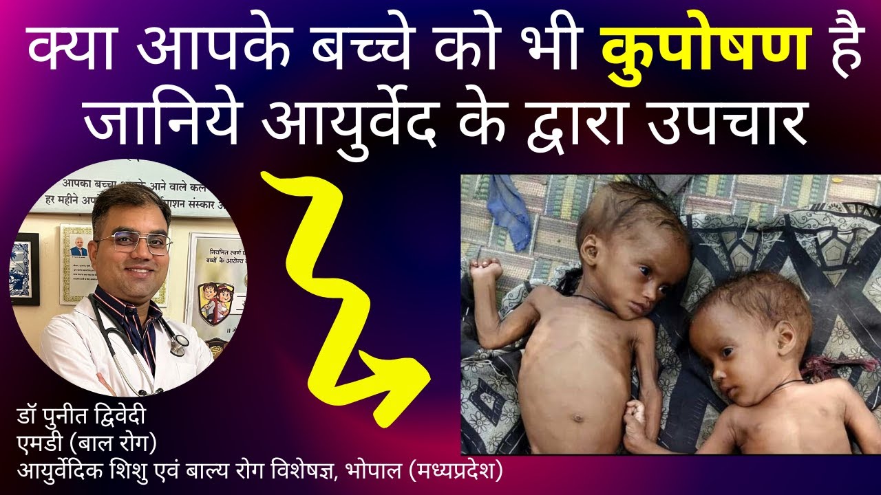 बच्चों में कुपोषण के कारण, लक्षण और आयुर्वेद के द्वारा उपचार | डॉ पुनीत द्विवेदी