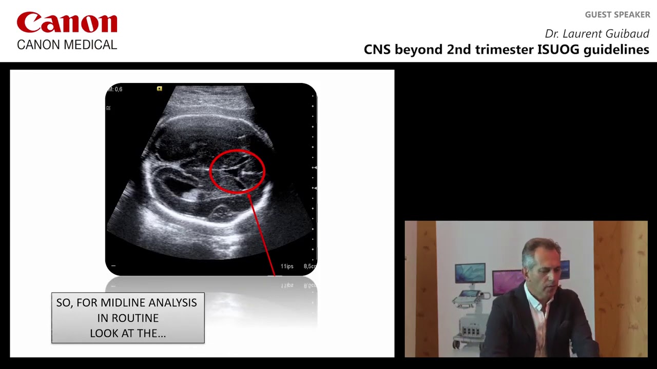 ISUOG 2018 Dr  Laurent Guibaud   CNS Beyond 2nd Trimester ISUOG Guidelines