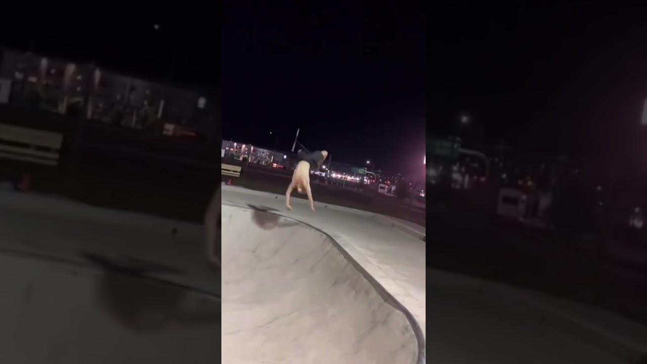 Worst Backflip Fail You&rsquo;ll See! #scooter