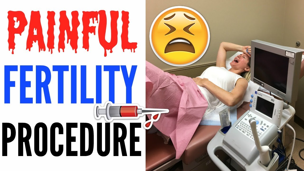 PAINFUL FERTILITY PROCEDURES