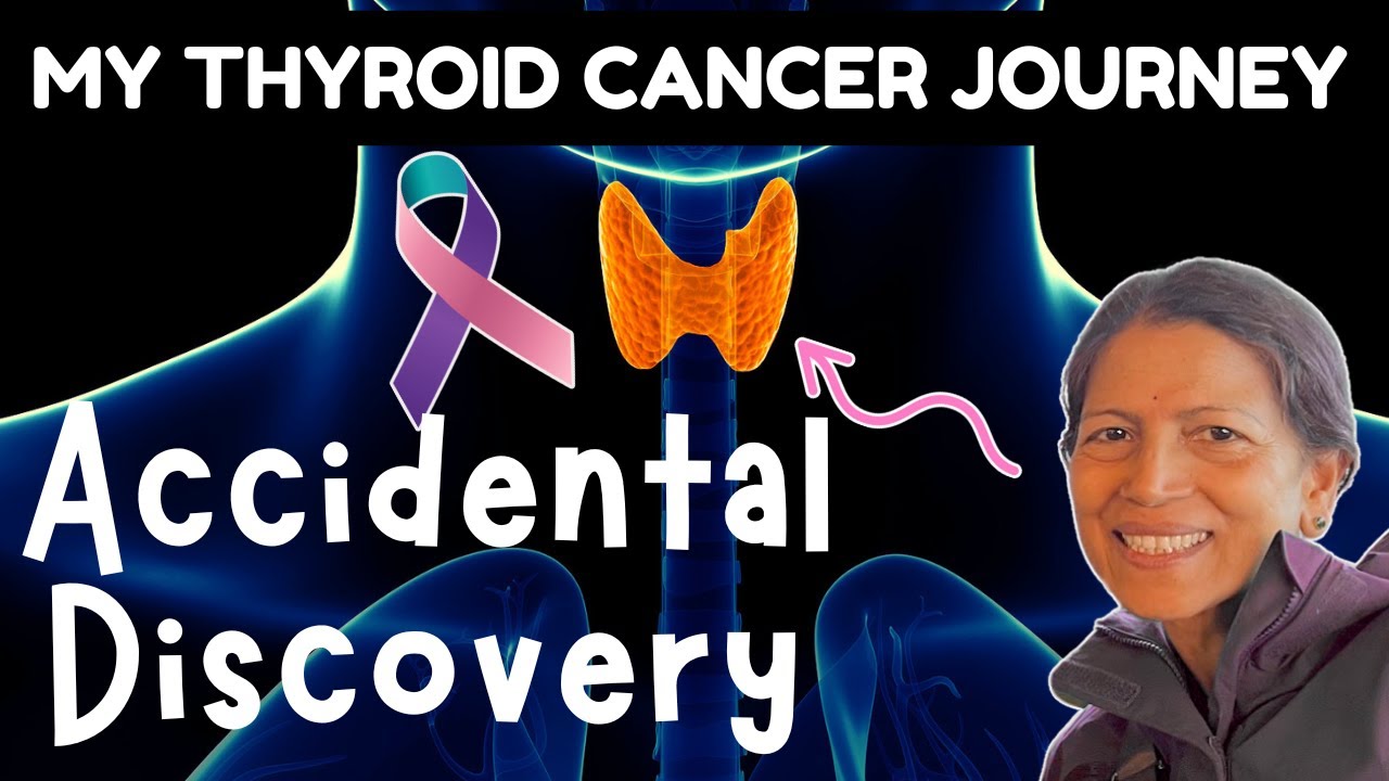 What Happened After My Surprising THYROID CANCER Diagnosis?🦋