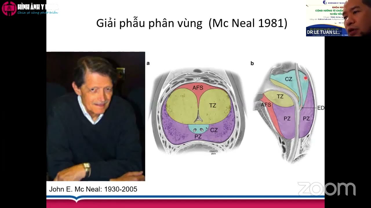 Cộng hưởng từ ung thư tuyến tiền liệt - TS.BS. Lê Tuấn Linh