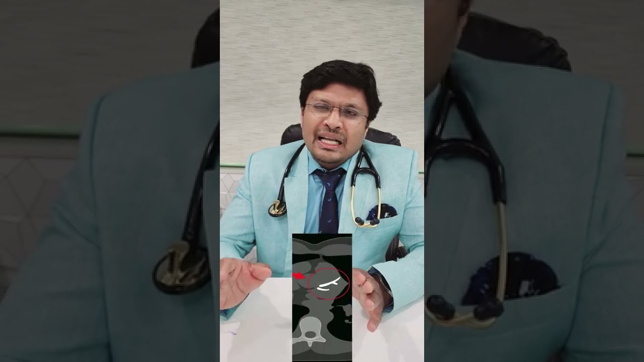 हार्ट के ब्लॉकेज CT CALCIUM SCORING से पता कर सकते है ?CT CALCIUM SCORING
