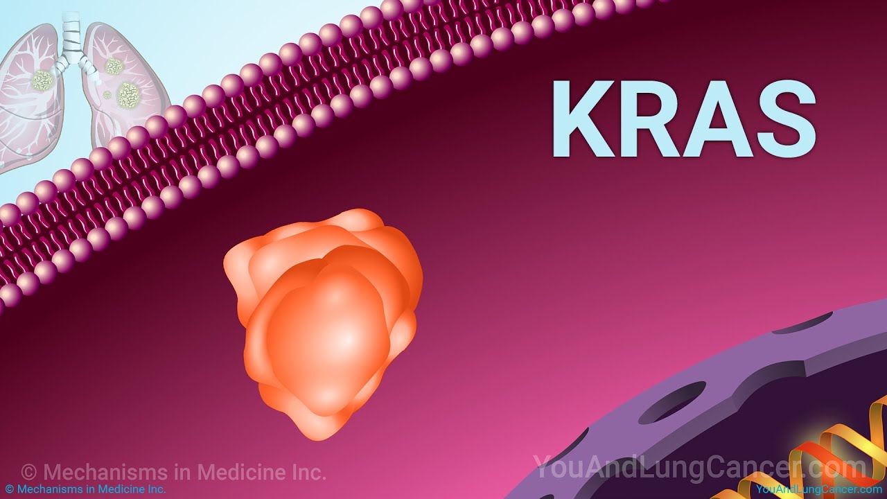 Understanding NSCLC Treatment When You Have a KRAS Mutation