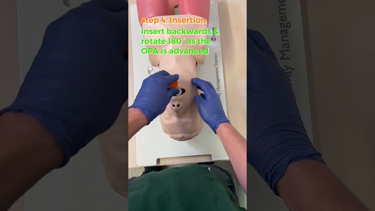 Master Oropharyngeal Airway Insertion Techniques #oropharyngealairway