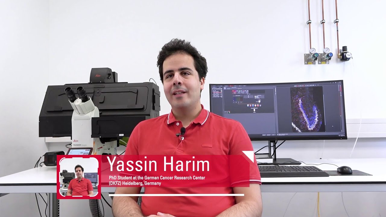 How imaging of large brain tissue sections benefits from THUNDER’s speed and image quality