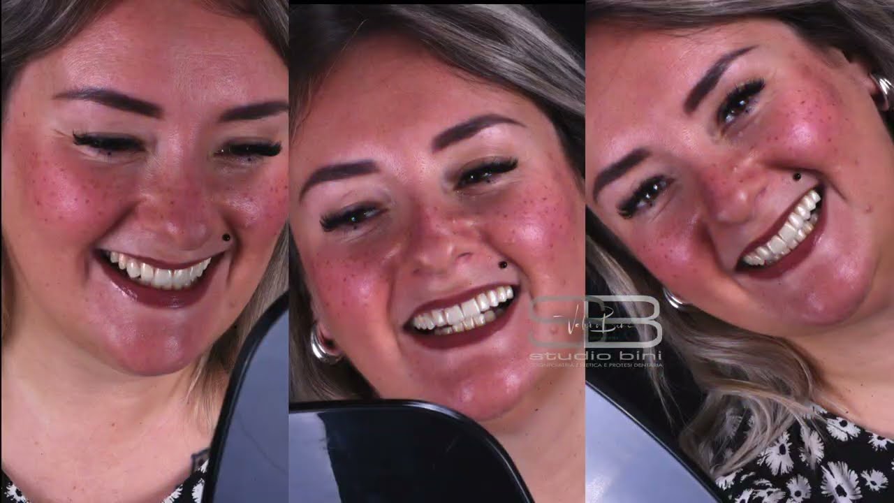 Soluzioni Digitali Personalizzate per l'Estetica del Sorriso