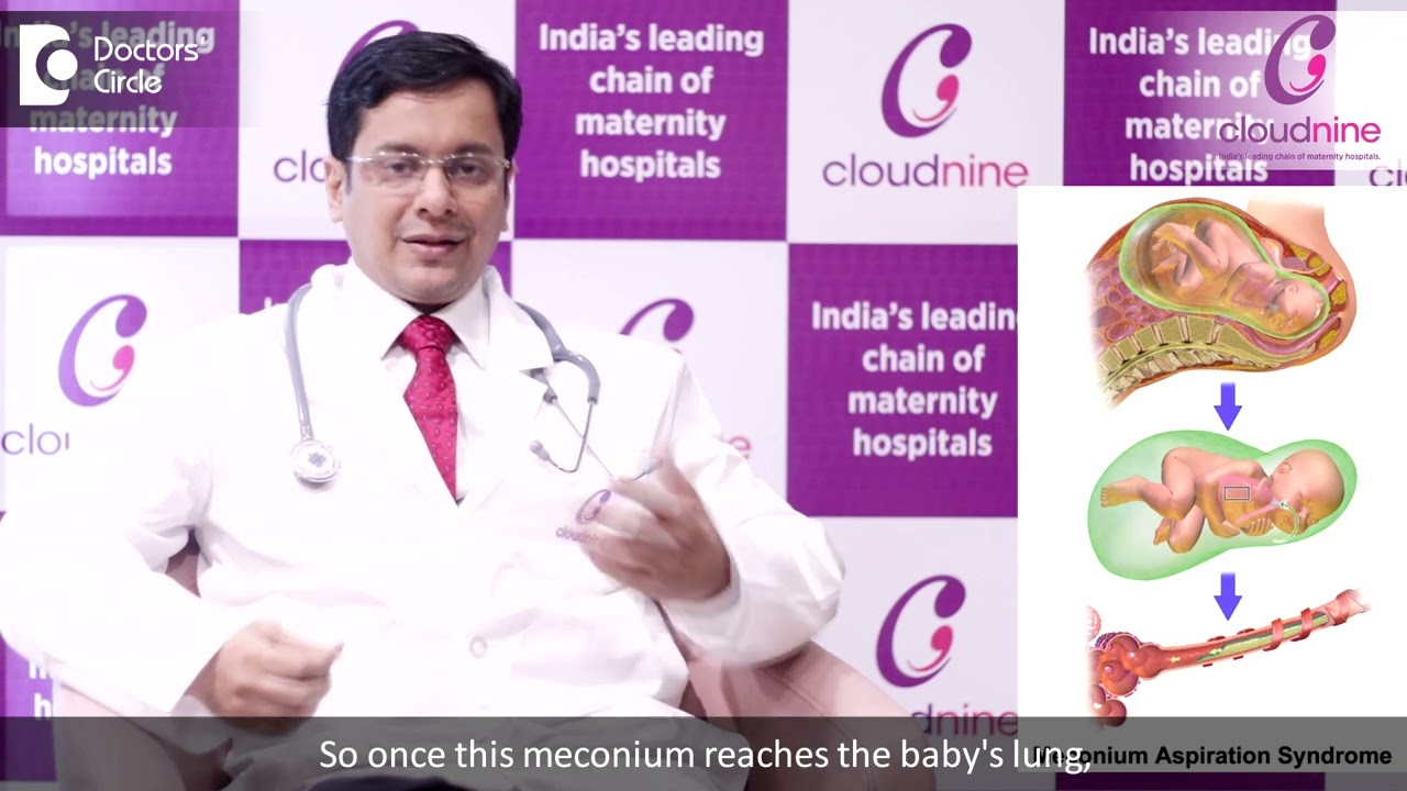 Czym jest sm&oacute;łka i dlaczego dzieci wydalają ją przed urodzeniem? Dr Piyush Jain, Szpital Cloudnine