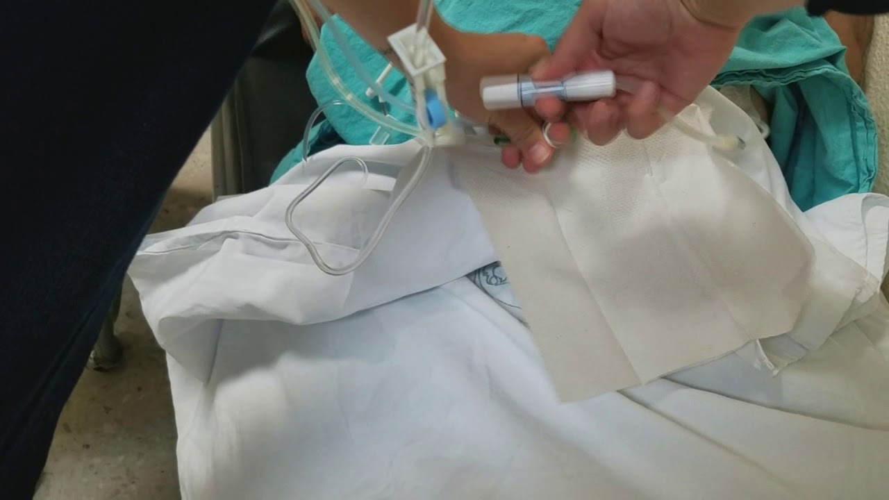 Dialisis Peritoneal en casa, realizado por alumnas de escuela Miguel Servet