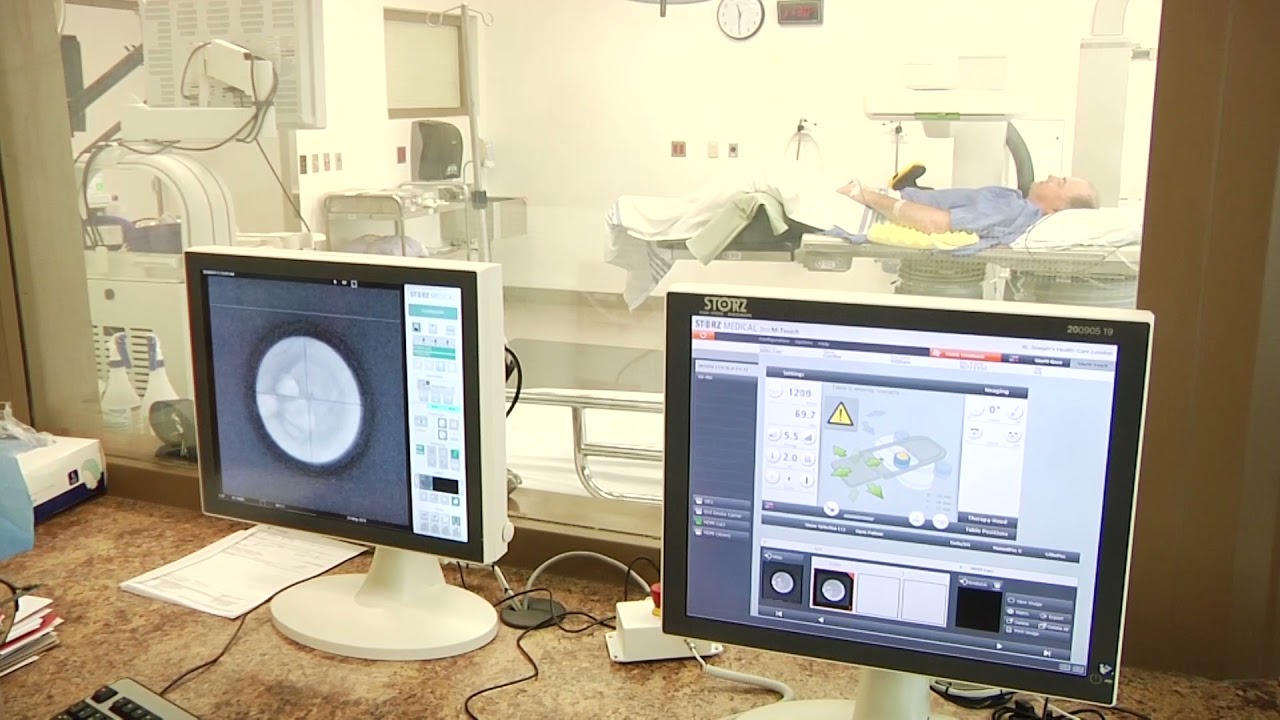 Lithotripsy Procedure at St. Joseph's Health Care