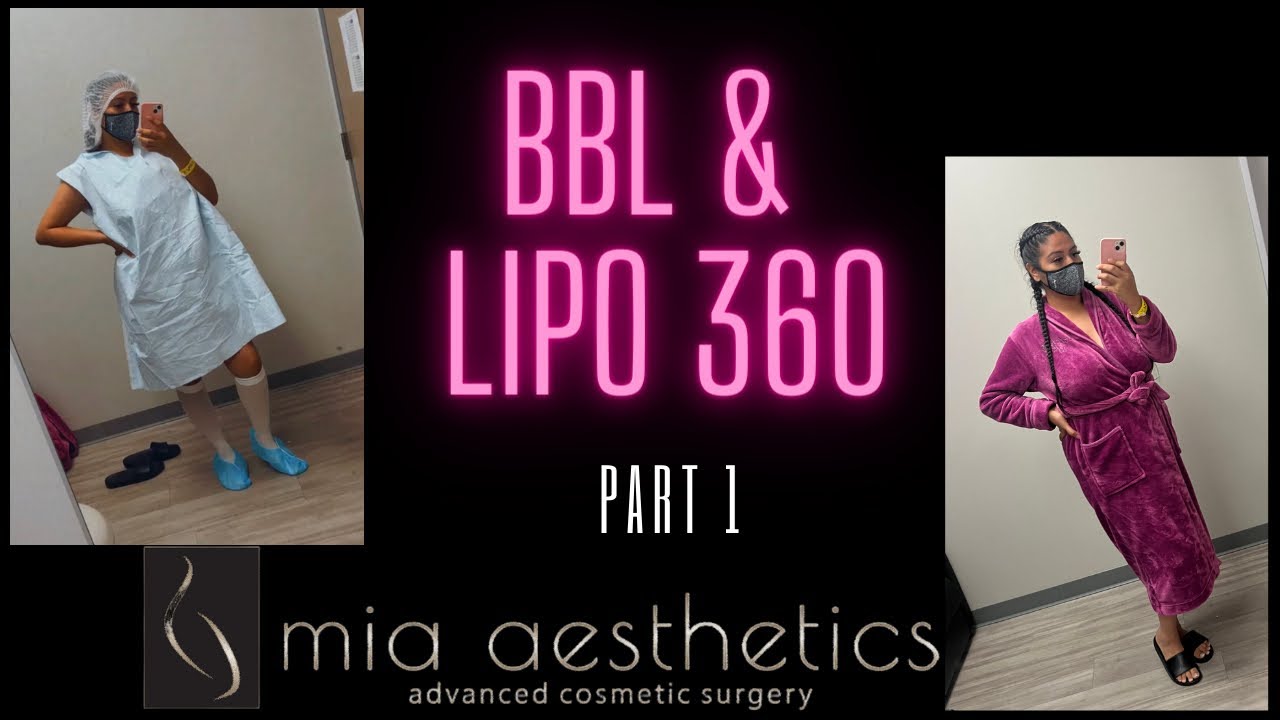 I GOT A BBL: PART 1 | MIA AESTHETICS | AUSTIN TX | DR. CHAREPOO