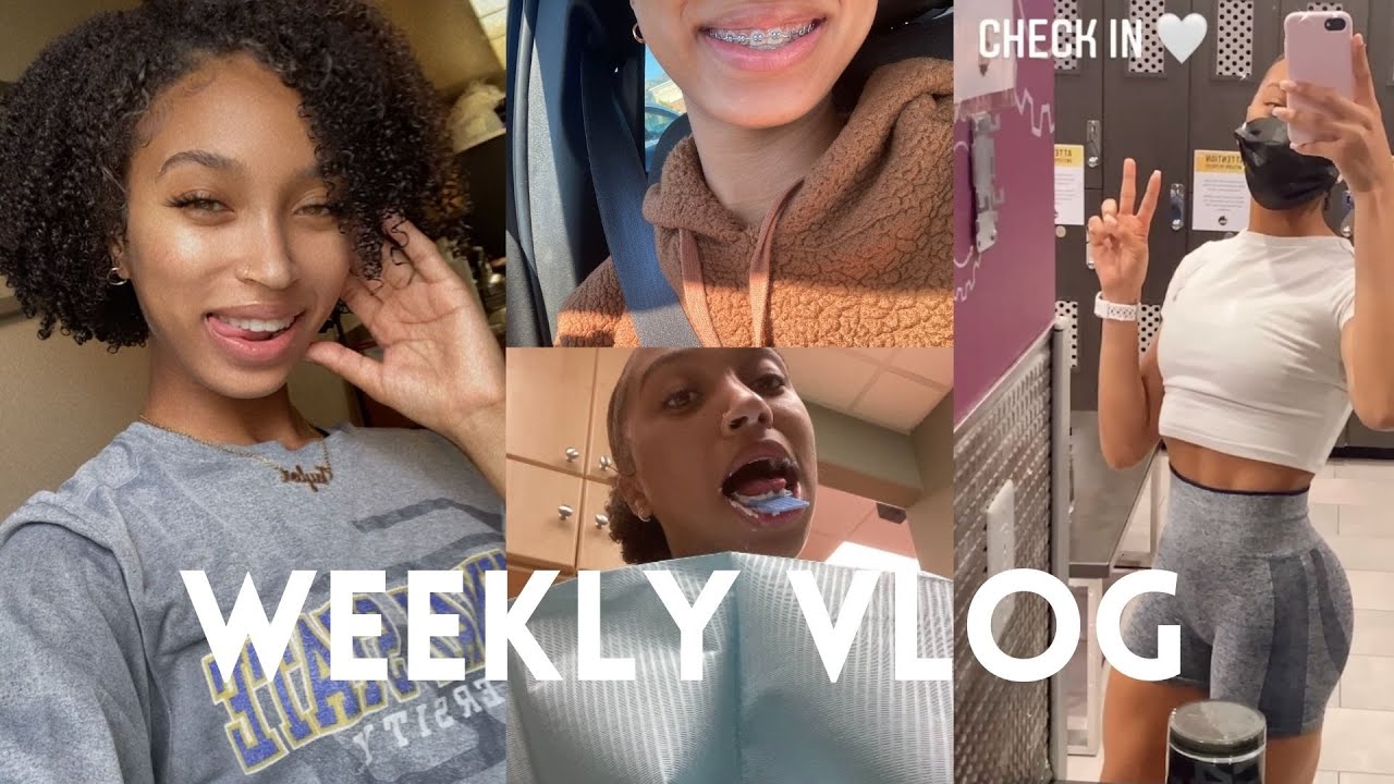 WEEKLY VLOG: GETTING MY BRACES OFF EARLY + RANTING.. AGAIN + WORKOUTS AT PLANET FITNESS