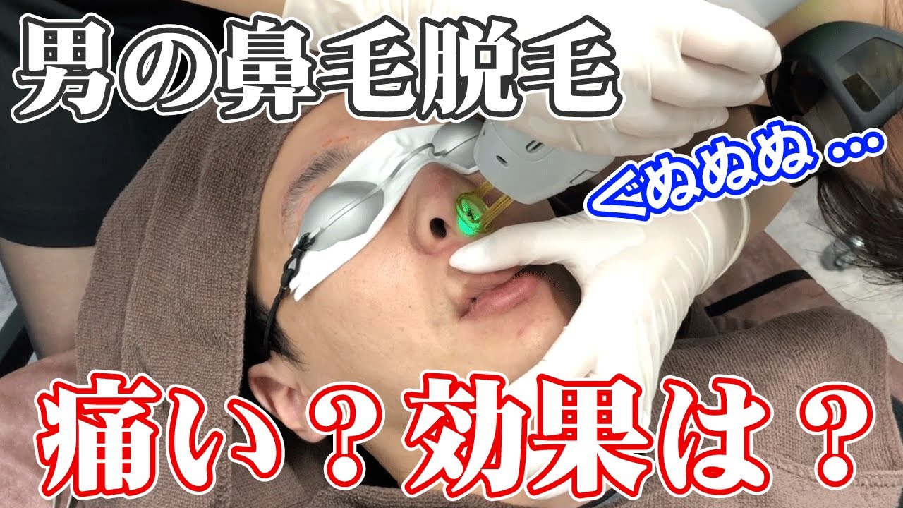 医療レーザーで鼻毛脱毛を完了させた男が全てを実況します！【ゴリラクリニック】
