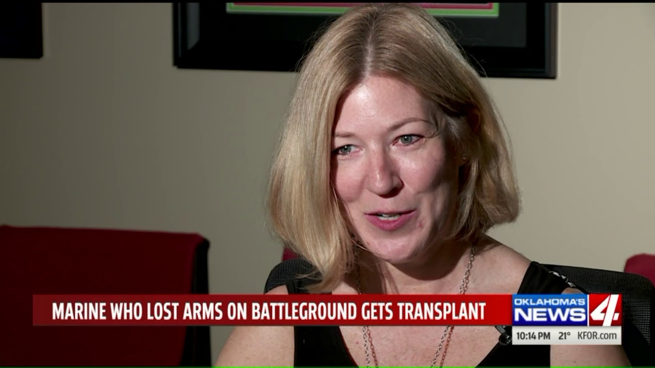 Return the Salute: Non-profit works to give amputee vets new life with new limbs