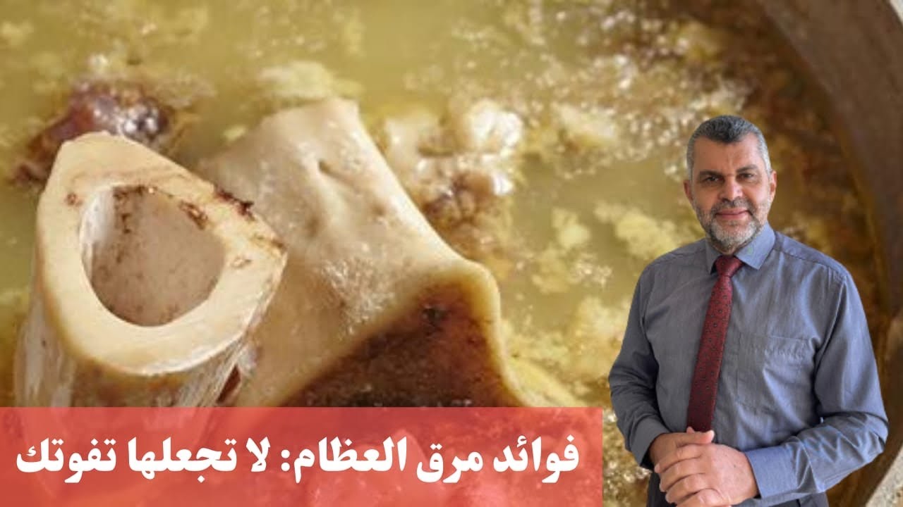 88-فوائد مرق العظام: لا تجعلها تفوتك
