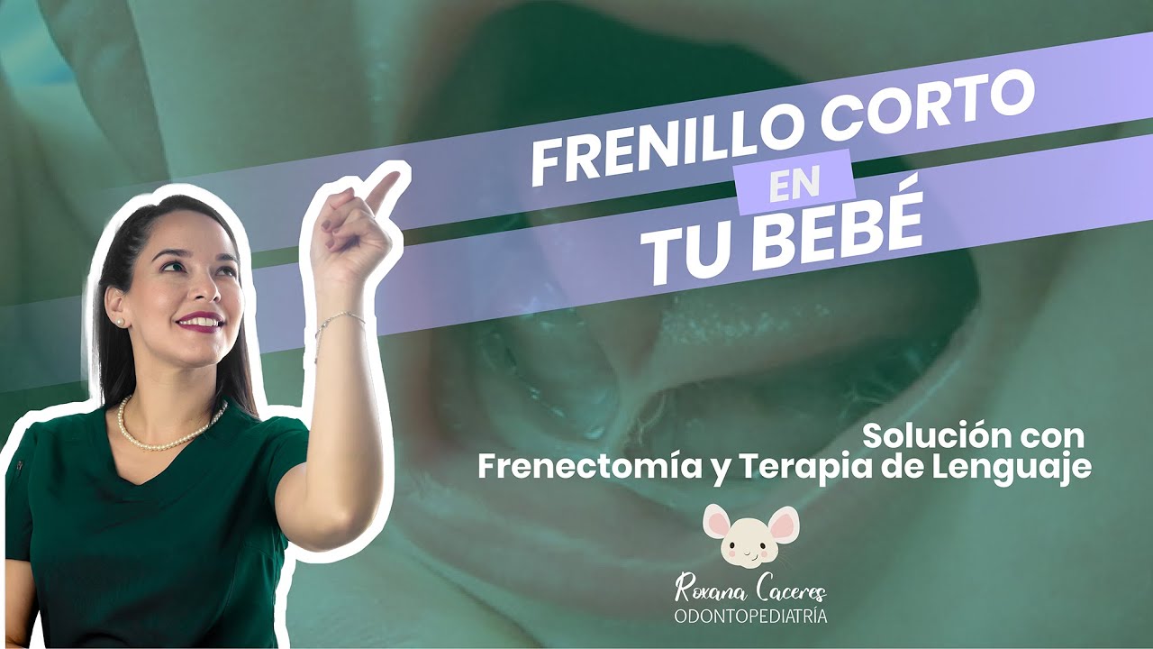 Frenillos en Bebés Problemas en la Lactancia y Lenguaje | Solución Frenectomía y Terapia de Lenguaje