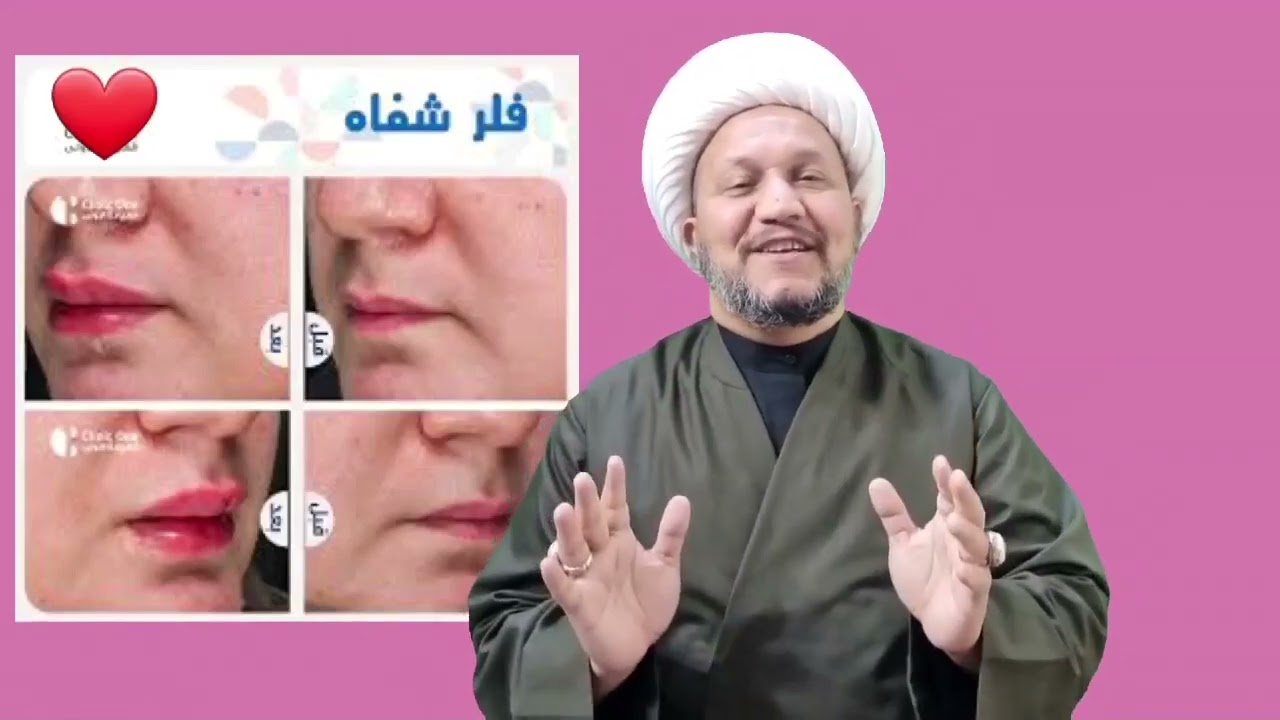 حكم إجراء عملية ( الفيلر )